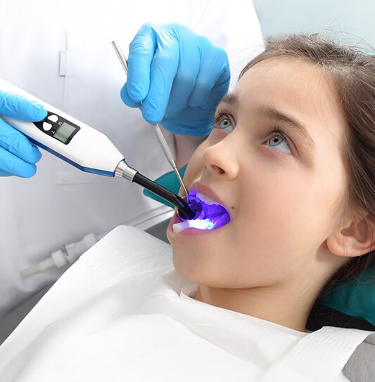 A dentist using a curing light to harden the plastic dental sealant on a young girl’s tooth