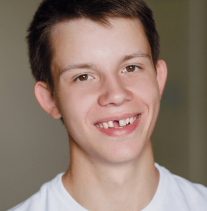 Preteen boy with knocked out tooth