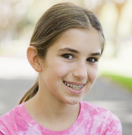 Preteen girl with phase 1 orthodontics
