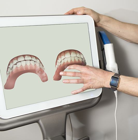 Digital smile impressions on chairside computer